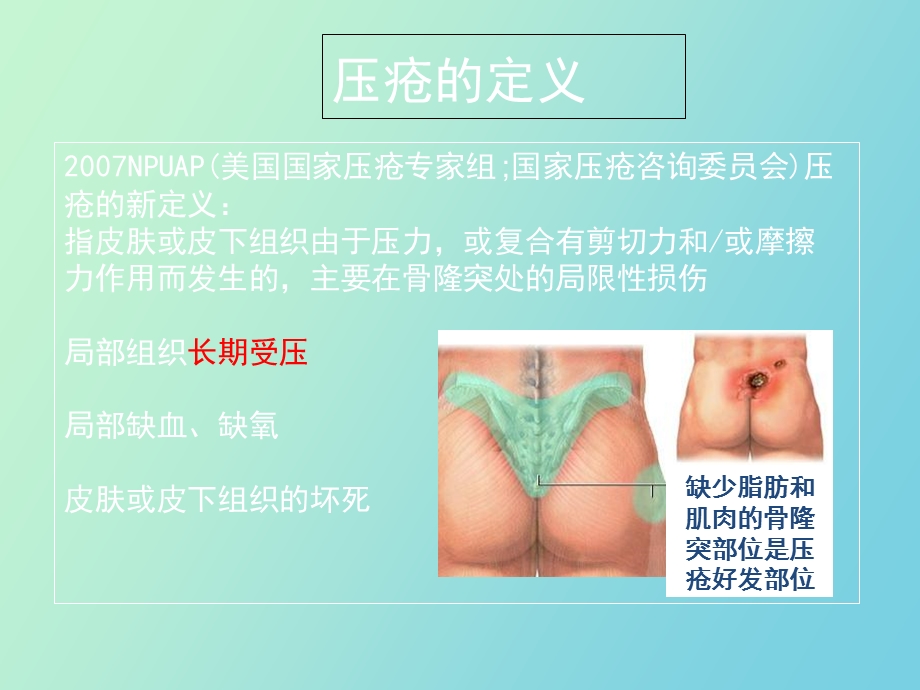 压疮的防治以及敷料的运用.ppt_第3页