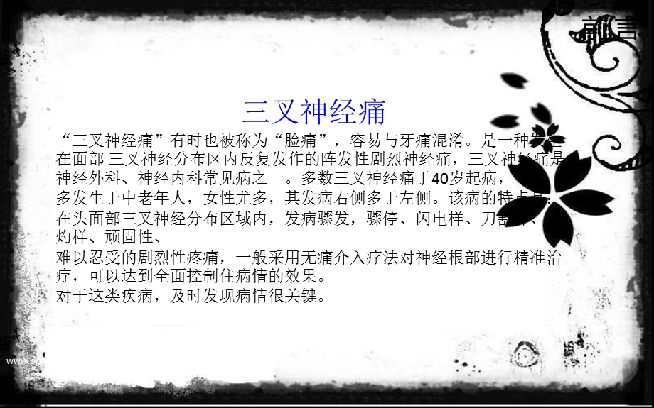 老年人三叉神经痛的疼痛位置在哪.ppt_第2页