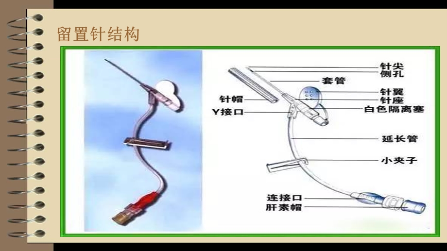 小儿静脉留置针穿刺技巧.ppt_第2页