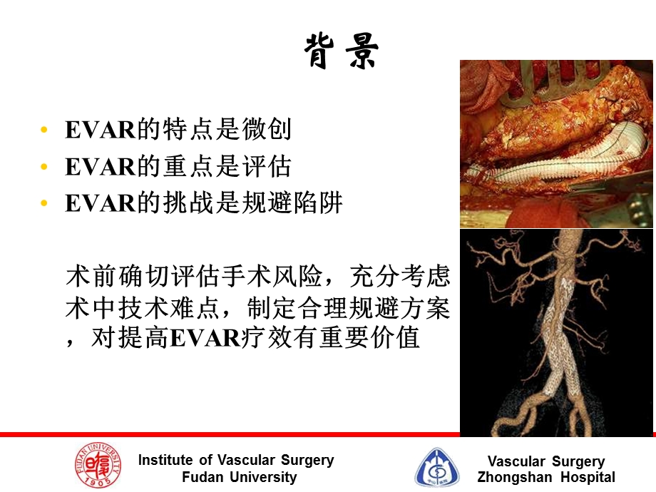 腹主动脉瘤EVAR术中陷阱及规避技巧.ppt_第3页