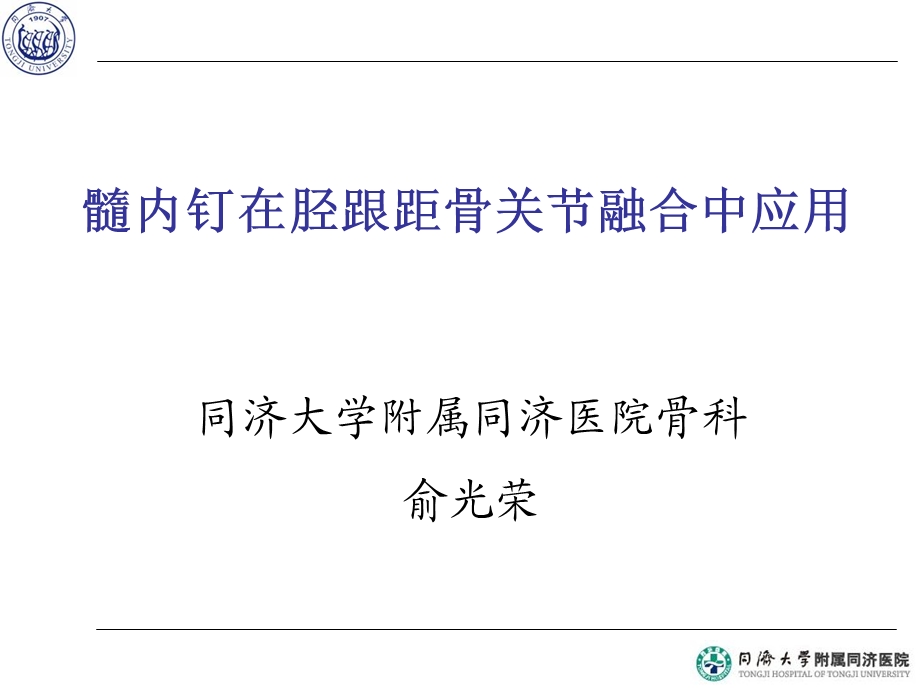 髓内钉在胫跟距骨关节融合中应用.ppt_第1页