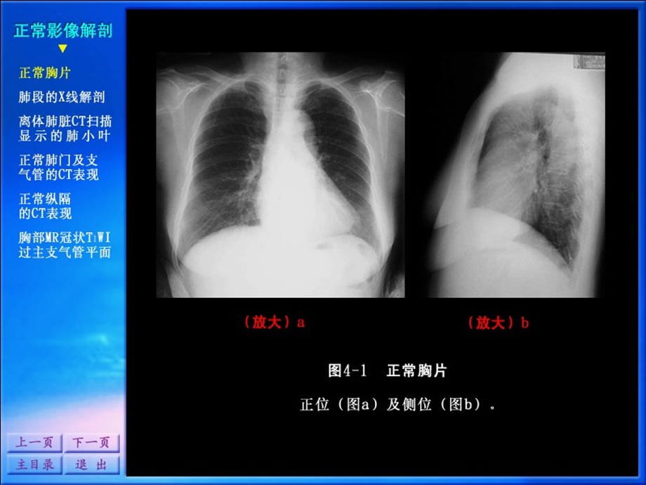 影像诊断学系列图谱-呼吸系统.ppt_第2页
