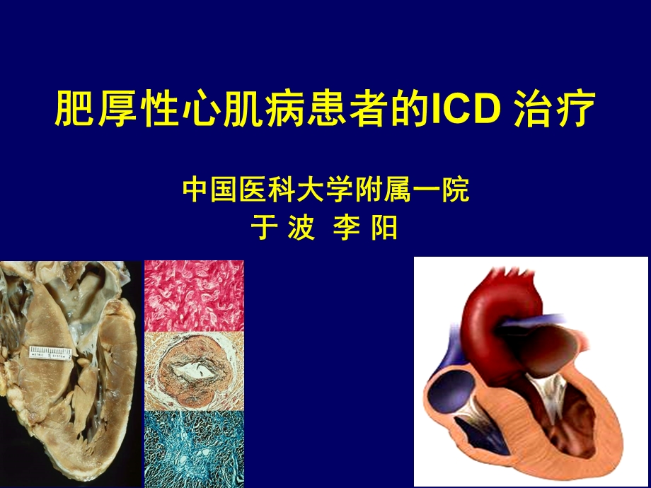 肥厚心肌病患者的ICD治疗中国医科大学附属一院于波李阳教学课件.ppt_第1页