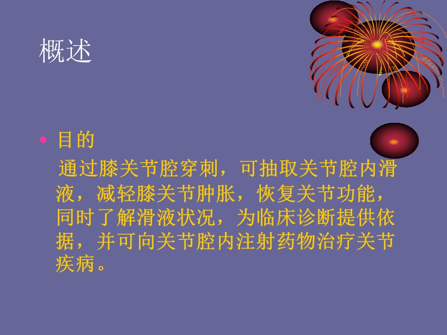 膝关节穿刺部位.ppt_第2页