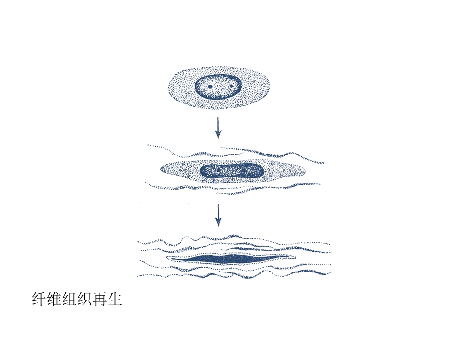 纤维组织愈合.ppt_第1页