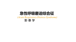 急性呼吸窘迫综合征(ARDS)的-影像学表现.ppt