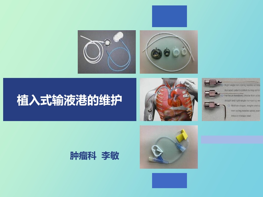 植入式输液港维护流程.ppt_第1页