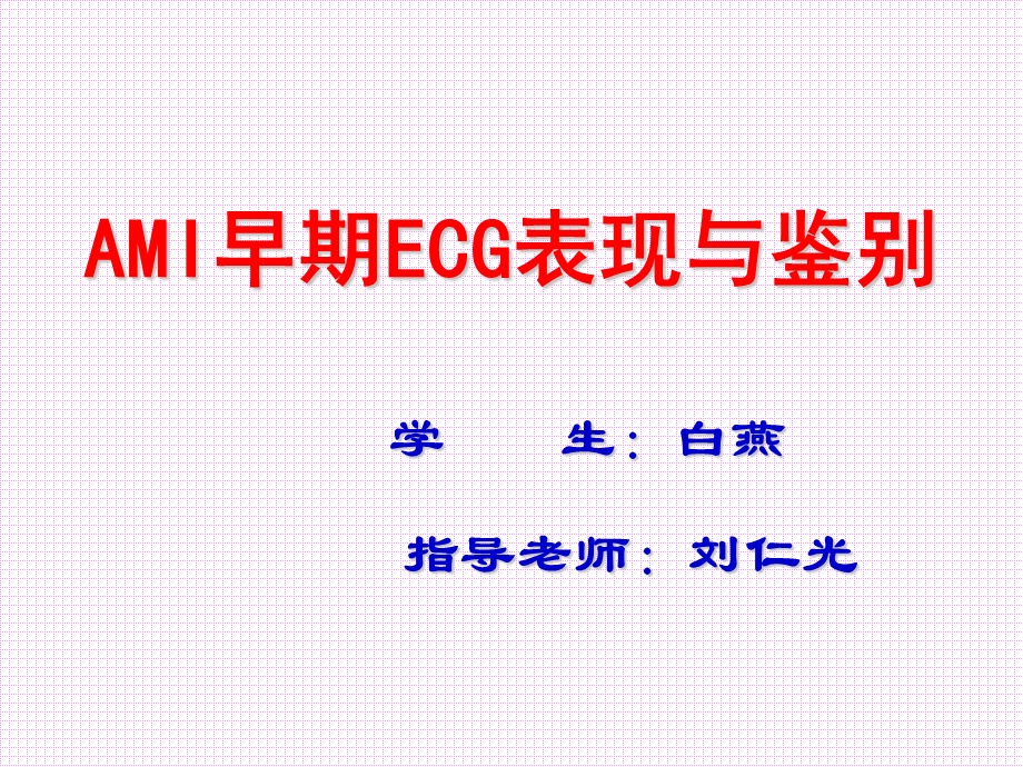 心肌梗死早期心电图表现与鉴别.ppt_第1页