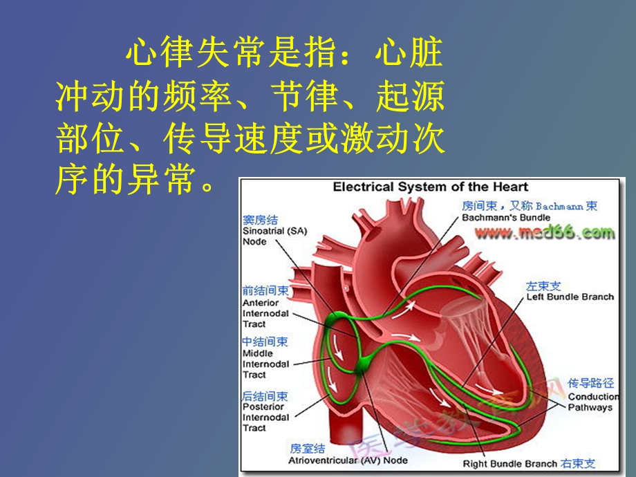 心律失常与治疗.ppt_第3页