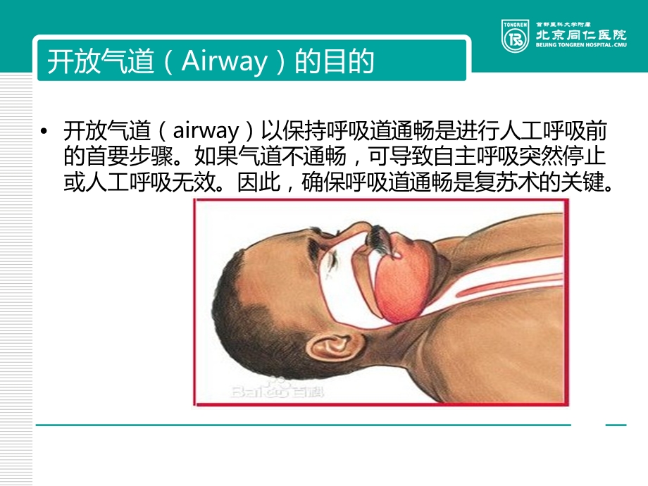 心肺复苏-开放气道.ppt_第2页