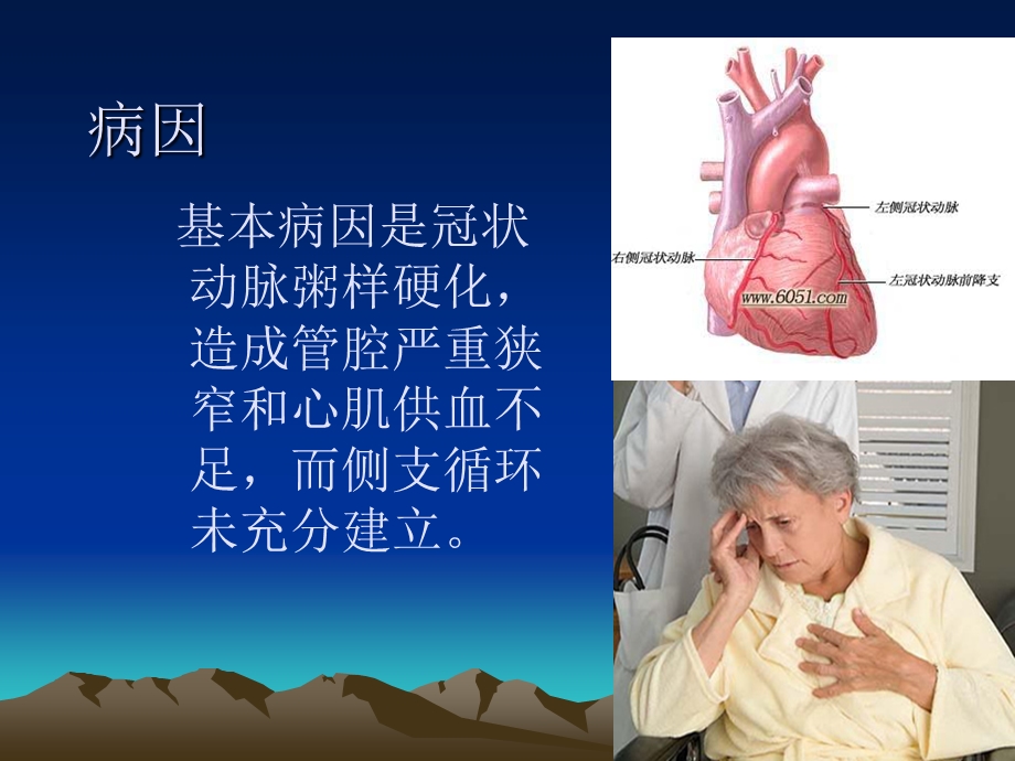 急性心肌梗死的护理措施.ppt_第3页