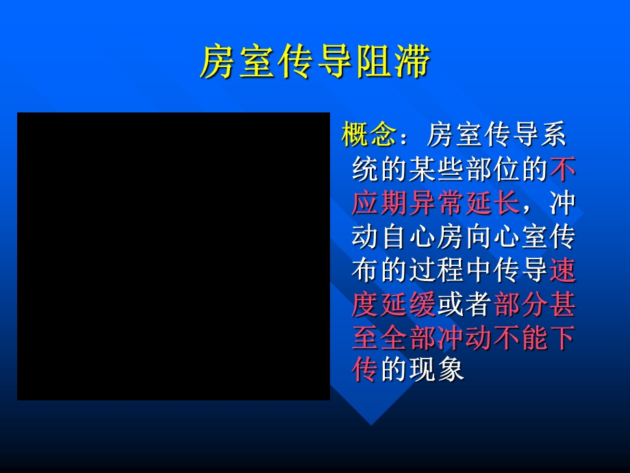 房室传导阻滞PPT.ppt_第2页