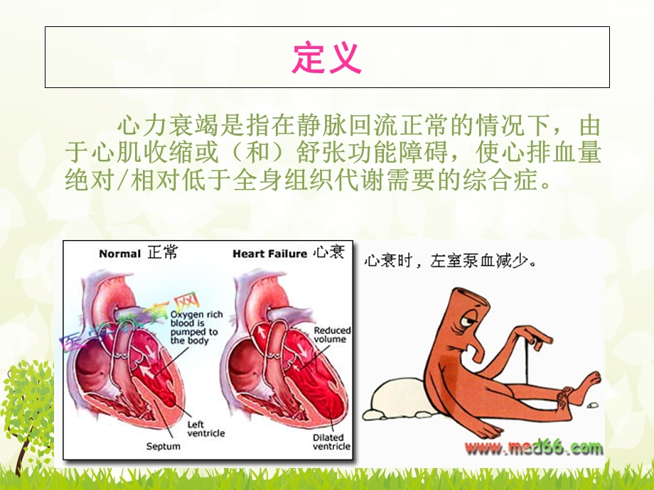 心力衰竭护理查房-ppt.ppt_第3页