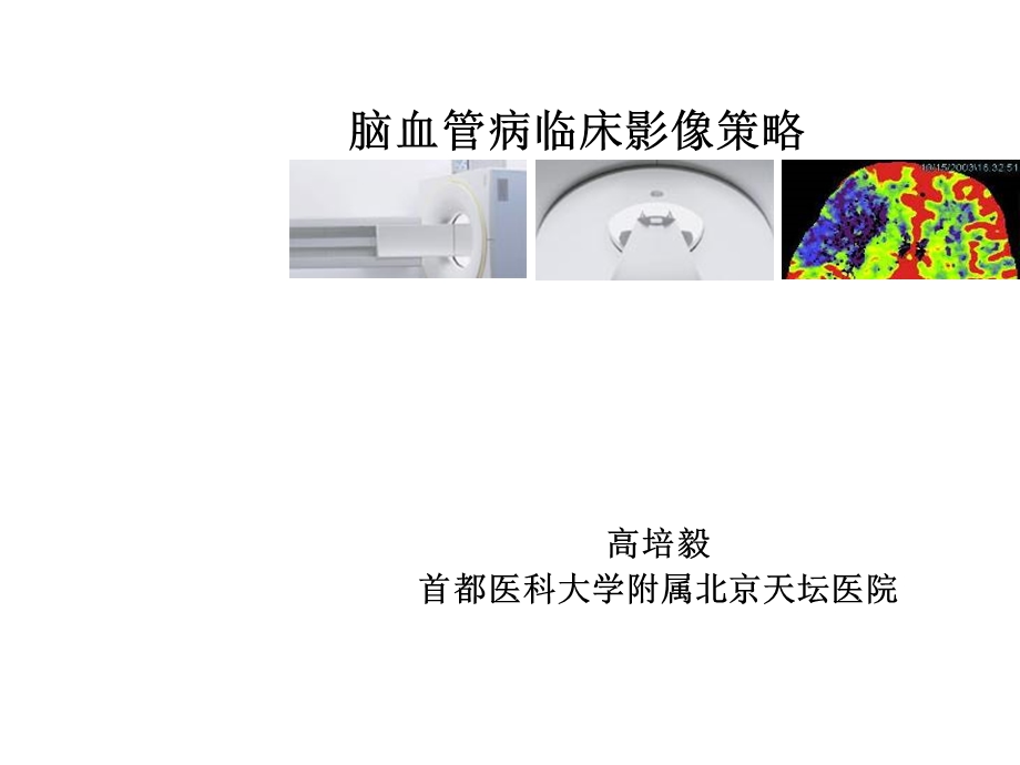 脑血管临床策略.ppt_第1页