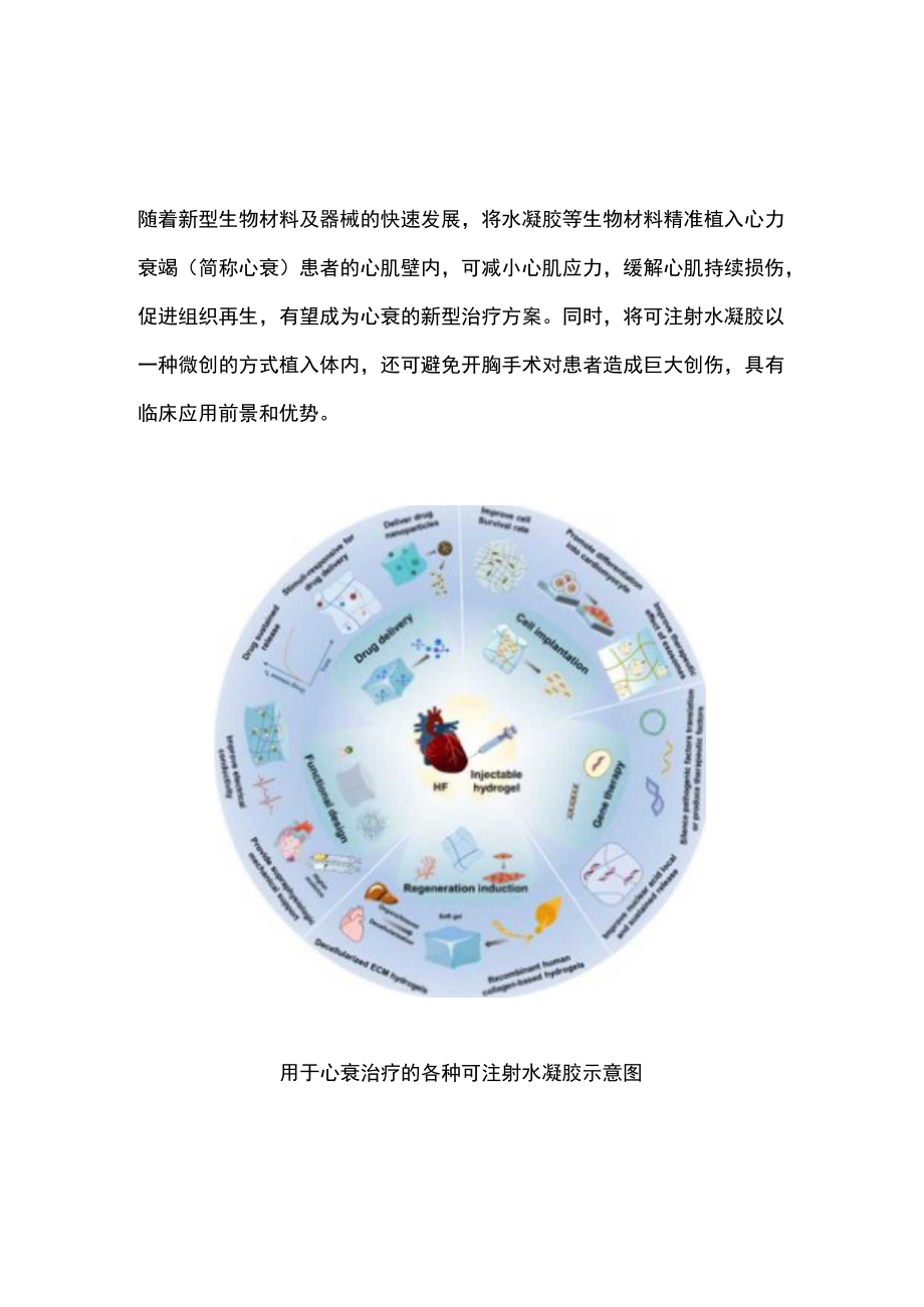 2023可注射水凝胶或成心衰治疗新方案（全文）.docx_第1页