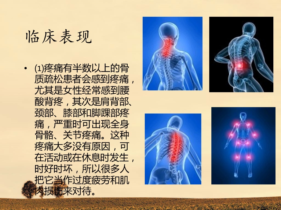 骨质疏松健康教育讲座.ppt_第3页