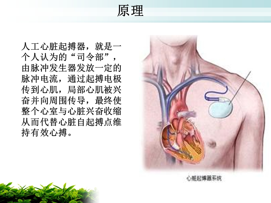 永久起搏器植入病人护理及相关注意事项.ppt_第3页