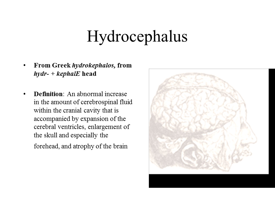 脑积水Hydrocephalus.ppt_第1页