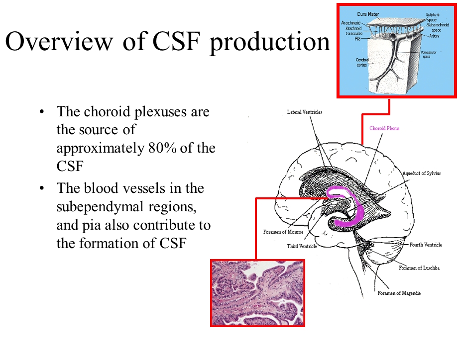 脑积水Hydrocephalus.ppt_第3页