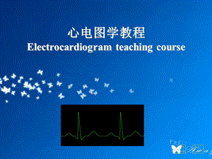 心电图学教学PPT彩图完整.ppt