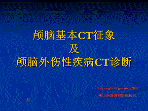 颅脑基本CT征象及颅脑外伤性疾病CT诊断.ppt