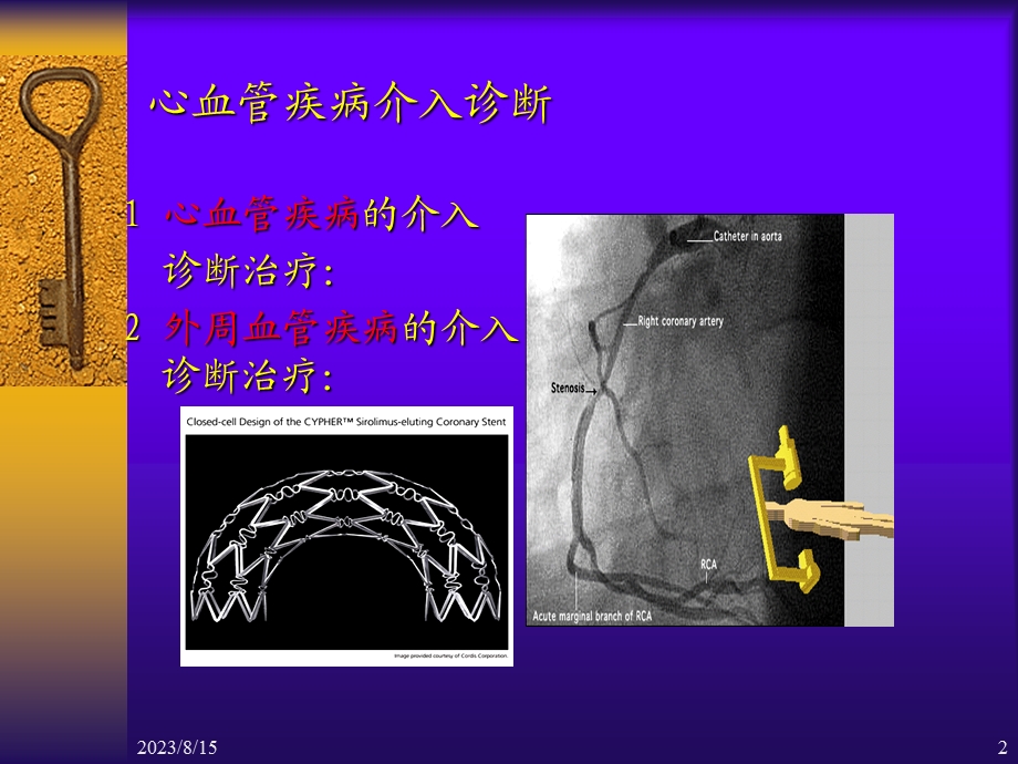 心血管疾病介入诊断治疗.ppt_第2页