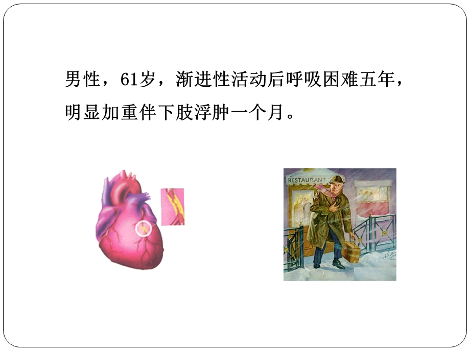 循环系统病例讨论.ppt_第2页