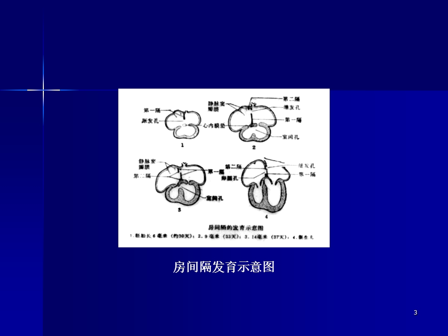 循环系统影像学诊断.ppt_第3页