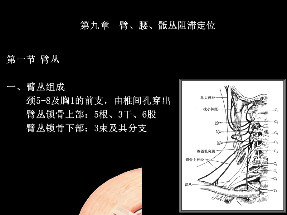 臂、腰、骶丛阻滞定位.ppt_第1页