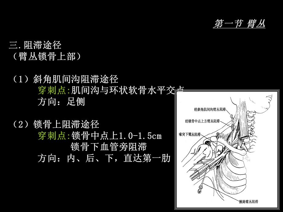 臂、腰、骶丛阻滞定位.ppt_第3页