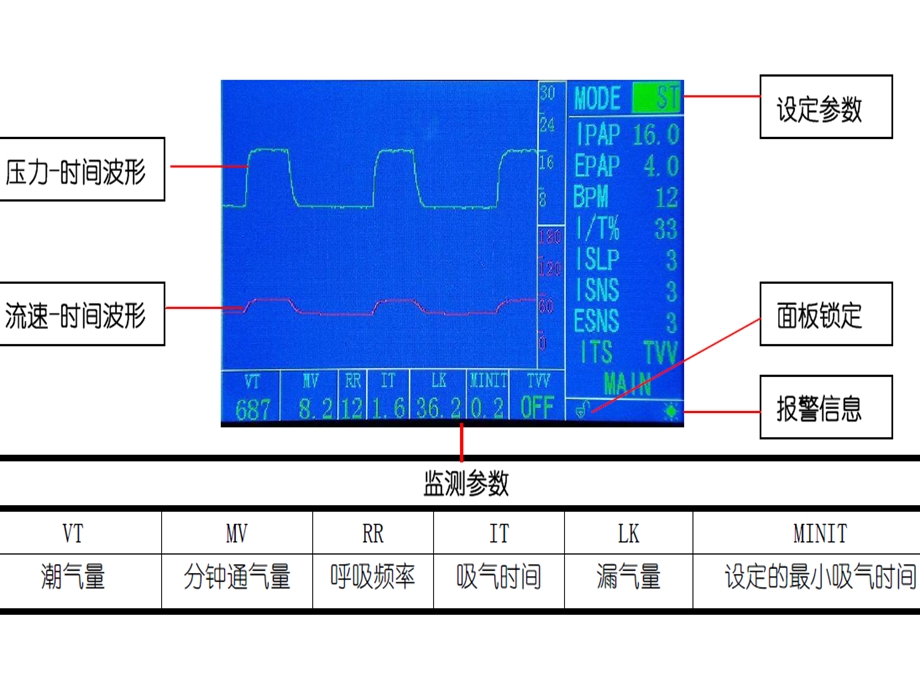 无创呼吸机Flexo应用.ppt_第2页