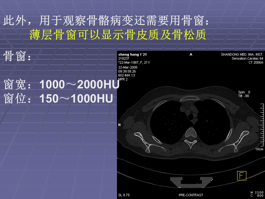 正常胸肺部CT影像学表现.ppt_第3页