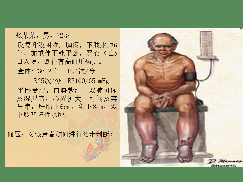 心力衰竭常见疾病.ppt_第3页