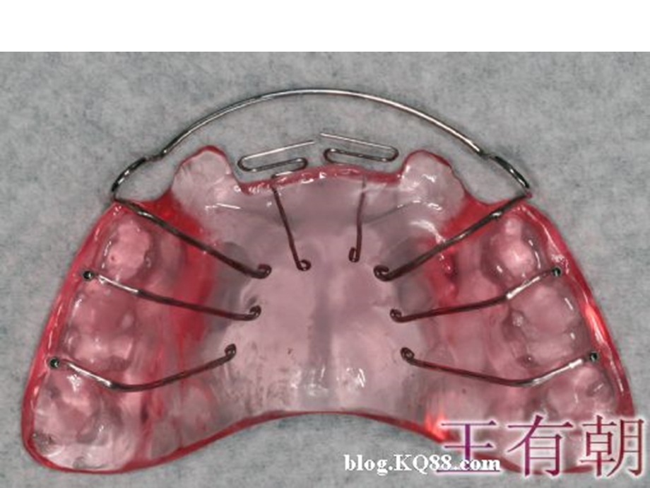 正畸活动矫治器图谱.ppt_第2页