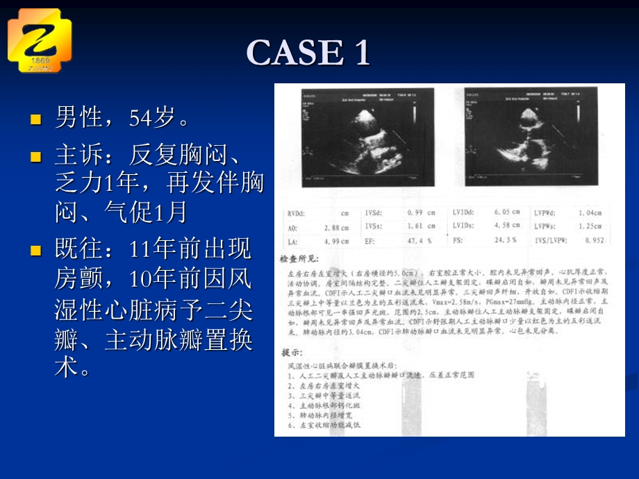 风心房颤射频消融例.ppt_第2页