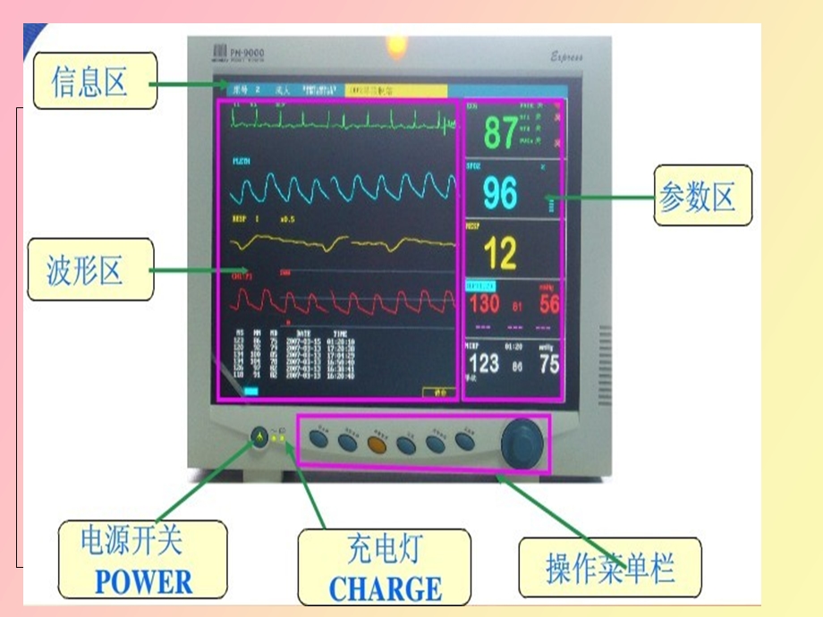 心电监测技术中医护理技术操作规程.ppt_第3页