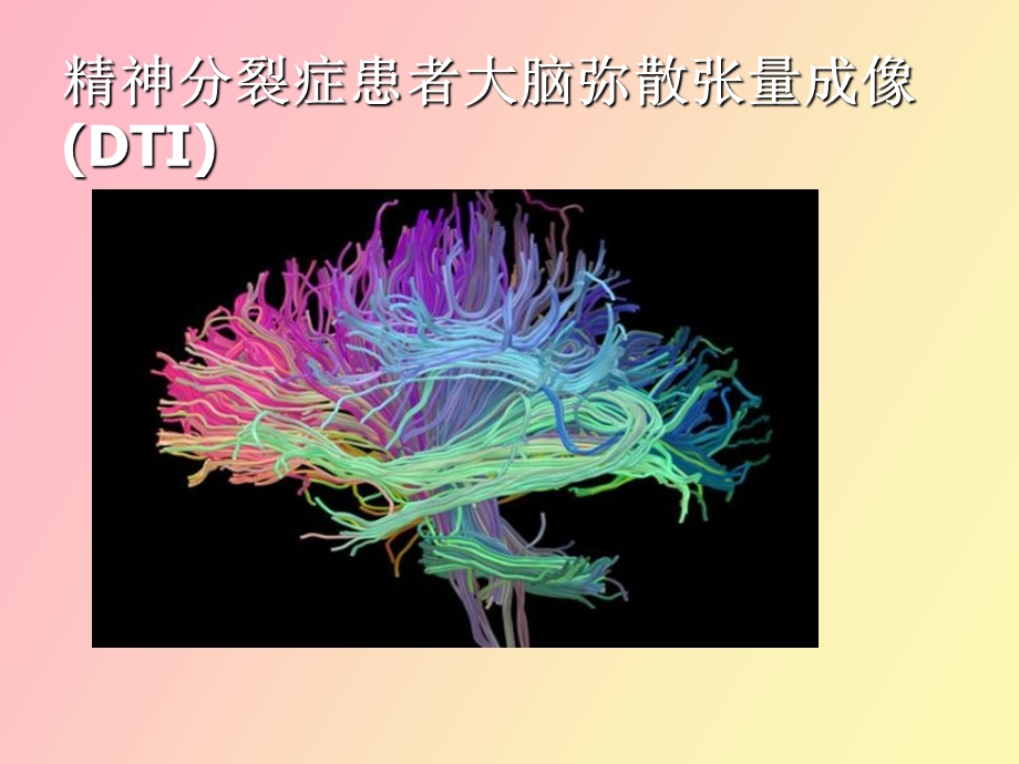 医学成像技术透视奇妙人体构造.ppt_第2页