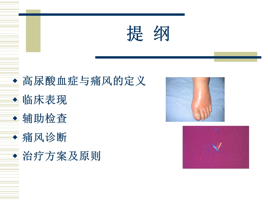 痛风的诊治指南解读ppt.ppt_第2页