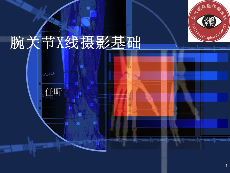 腕关节常见骨折与摄影方法.ppt_第1页