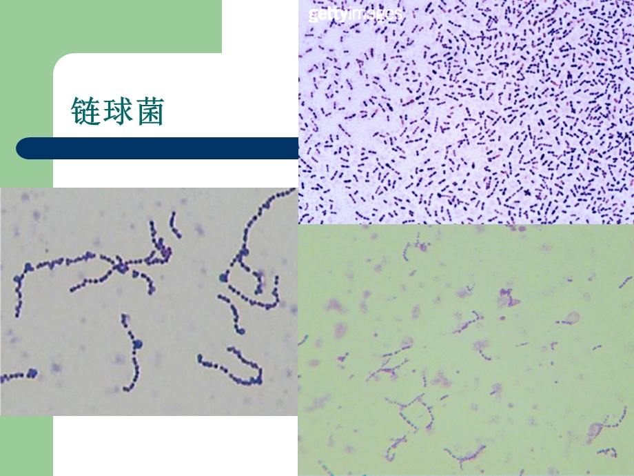 病原性球菌O试验血凝.ppt_第3页