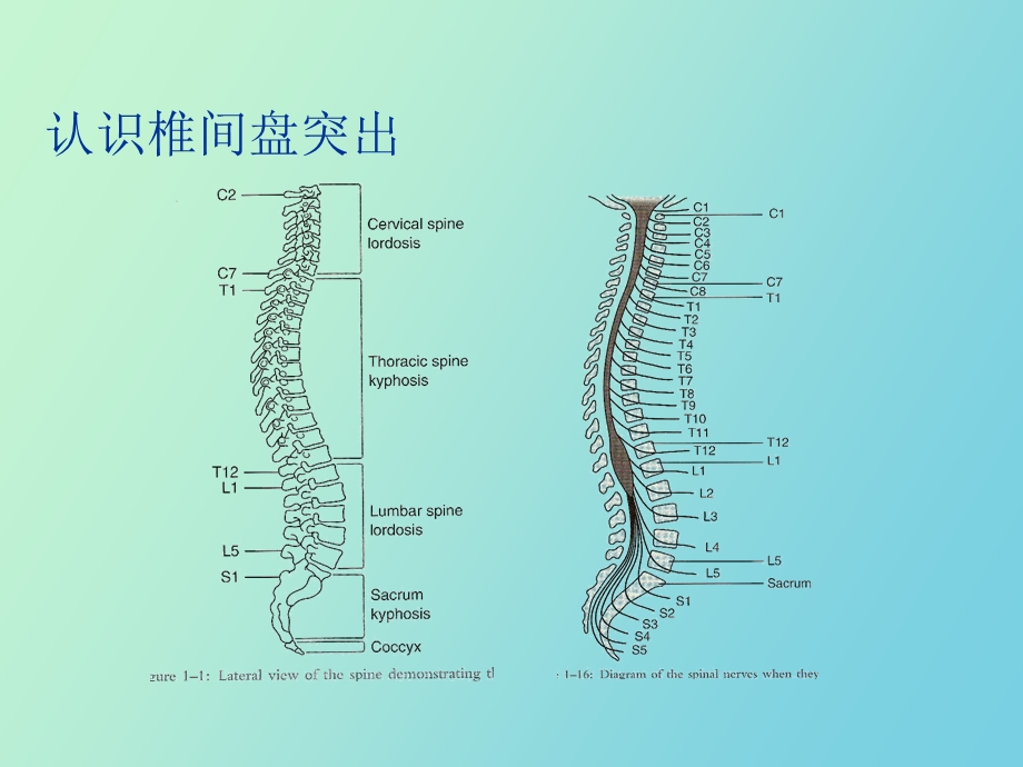 椎间盘突出微创治疗.ppt_第3页