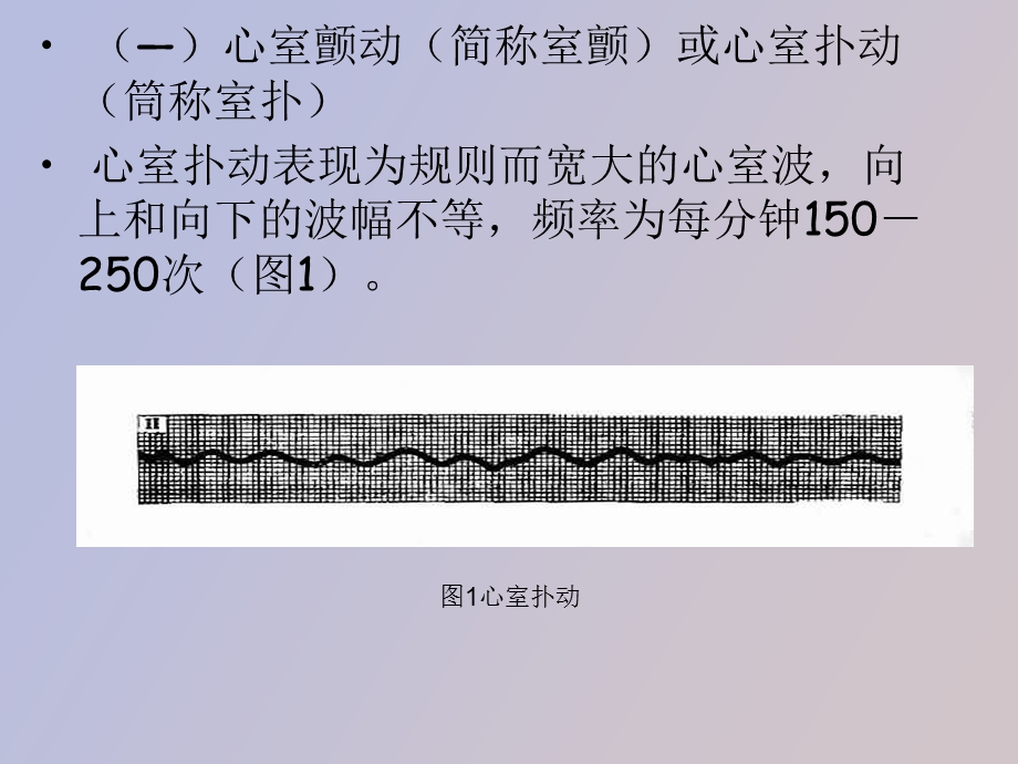 心脏电复律电击.ppt_第3页