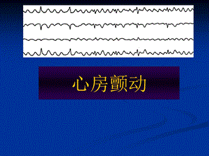 心房颤动课件PPT.ppt