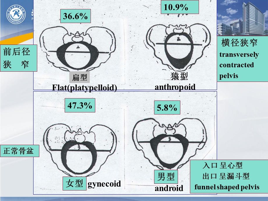 难产转化12护理.ppt_第3页