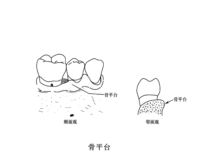 牙周病学第四版4ppt课件.ppt_第1页