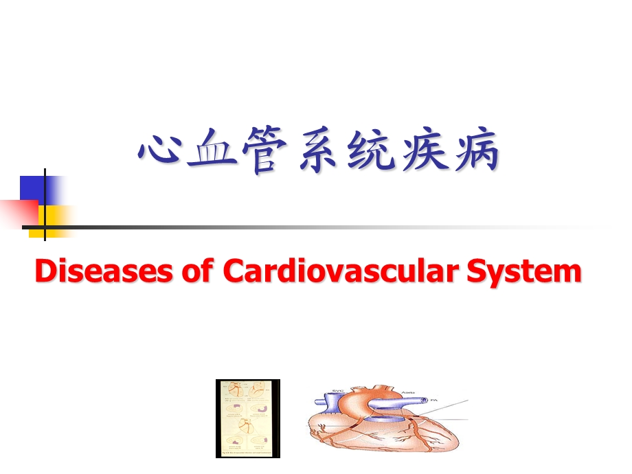 心血管系统疾病1-动脉粥样硬化、冠心病.ppt_第1页
