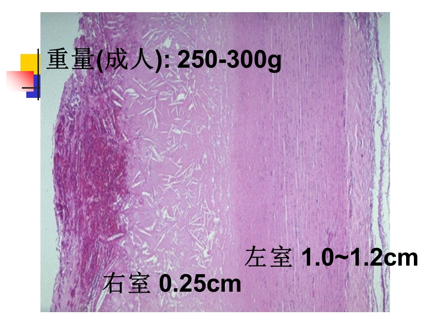 心血管系统疾病1-动脉粥样硬化、冠心病.ppt_第3页