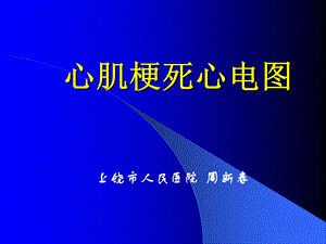 心肌梗死心电图-基层胸痛中心培训ppt课件.ppt