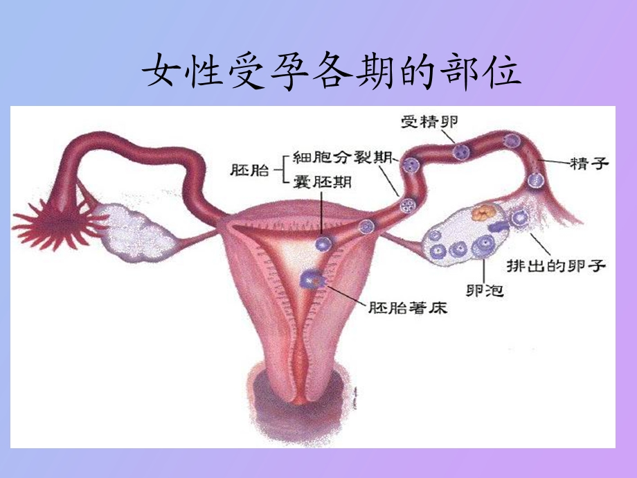 异位妊娠的治疗与护理.ppt_第2页