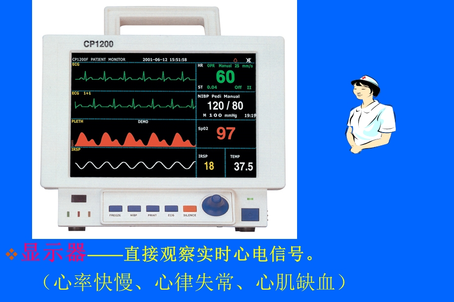 心电监护基本知识.ppt_第2页